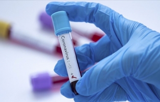 Türkiye'de koronovirüs'ten ilk ölüm