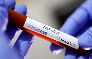 Dikkat çeken artış! Bir olan vaka sayısı 5'e çıktı