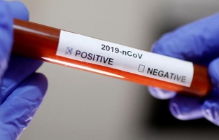 Osmaniye'de 1 köy, 1 mahalle ve 2 sokak karantinaya alındı