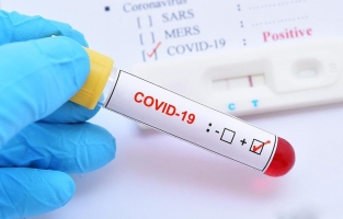 Bahçeli'nin ardından Sarıgül'de Koronavirüse yakalandı