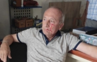 Yarbaşı Belediye Başkanı Kaynar'a çirkin saldırı