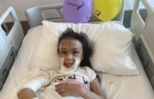 Vücudunun büyük bölümü yanan Iraklı 8 yaşındaki kıza Antalya'da estetik operasyon