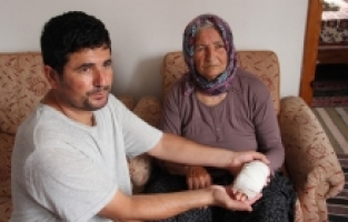 Mersin'de sahipsiz köpeğin saldırdığı yaşlı kadın elinden yaralandı