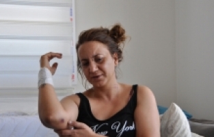 Adana'daki darp ve silahla yaralama olayıyla ilgili yakalanan 4 zanlıdan 1'i tutuklandı