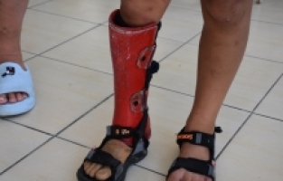 Ukraynalı Yana savaş mağduru çocukların “iyilik meleği“ oldu