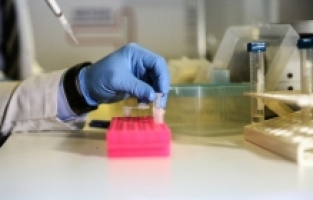 Kalp damarı tıkanıklığına neden olan spesifik genler araştırılacak