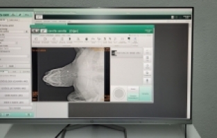 Antalya'da yaralı caretta caretta kurtarıldı