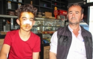 Antalya'da sahipsiz köpeklerden kaçarken otomobil çarpan genç yaralandı