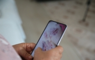 Hatay'da köpeklerin saldırısına uğrayan kadının kolunda his kaybı oluştu